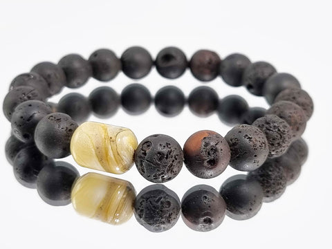 Cherry Amber Round Beads Stretch Bracelet